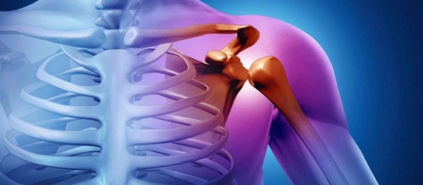 Ρήξη τένοντα ώμου: Με αυτό τον τρόπο θα απαλλαγείτε οριστικά από τον πόνο